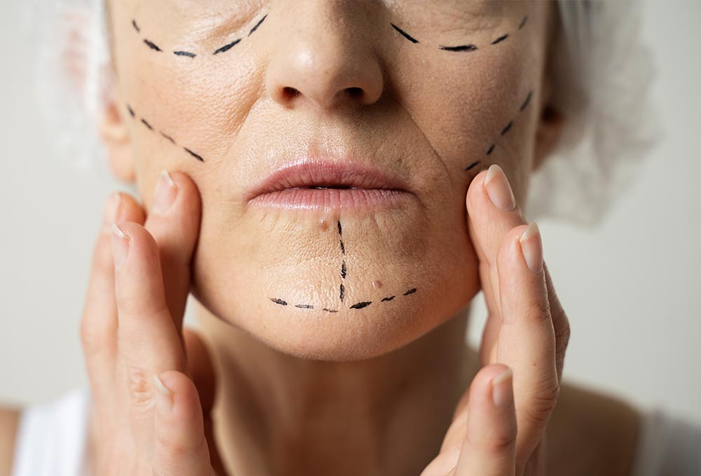 Reveal a new you confidence through surgery and radiate confidence